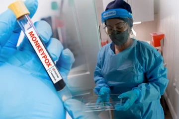 குரங்கம்மை தொடர்பில் வழிகாட்டல் கோவை!