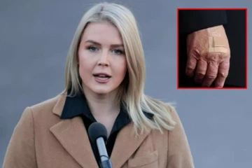 டிரம்பின் வலது கையில் பேண்டேஜ் ; கரோலின் லீவிட் விளக்கம்