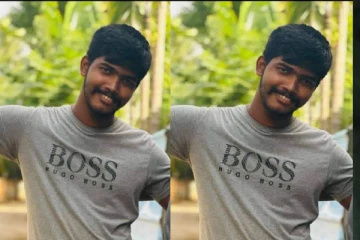 யாழில் நாய் கடிக்கு இலக்கான இளைஞனுக்கு நேர்ந்த துயரம்! பழகியவர்களை வைத்தியசாலையை நாடுமாறு அழைப்பு