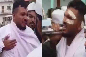 நள்ளிரவில் திடீரென.., விமான விபத்தில் தப்பிய நபரின் தற்போதைய நிலை