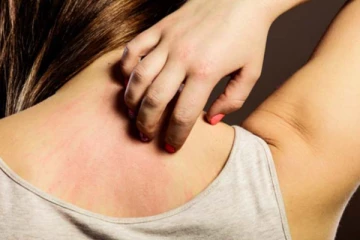 அழகைக் கெடுக்கும் படர் தாமரையினால் அவதியா? இதை மட்டும் செய்தாலே போதும்