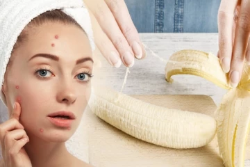 அடடா.. வாழைப்பழத்தோலில் இவ்வளவு நன்மை இருக்கா? இது தெரியாமல் போச்சே