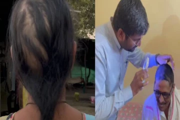 திடீரென வழுக்கையான கிராம மக்களின் தலை - ஆய்வில் வெளியான அதிர்ச்சி தகவல்