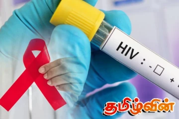 எச்.ஐ.வி தொற்றுக்குள்ளான இளைஞர்களின் எண்ணிக்கையில் அதிகரிப்பு