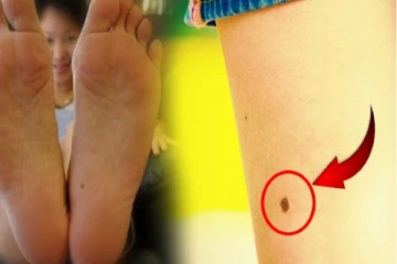 பெண்களே...! உங்களுக்கு இந்த இடத்தில் மச்சம் இருக்கா? அப்போ நீங்க இப்படித்தான் இருப்பீங்க