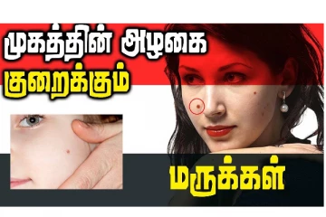 முகத்தின் அழகை கெடுக்கும் மருக்கள் - தடுக்க சூப்பரான டிப்ஸ்!