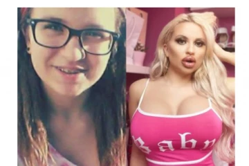 ஆஸ்திரேலியாவில் இளம் பெண் தன் மார்பழகை மேம்படுத்த செய்த செயல் - வைரலாகும் புகைப்படம்!