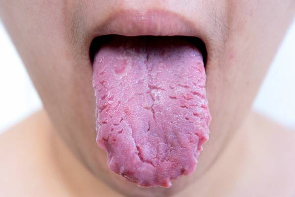 நாக்கில் இந்த அறிகுறிகள் இருக்கா? அப்போ இந்த ஆபத்து உறுதி | What Do Different Tongue Textures Mean