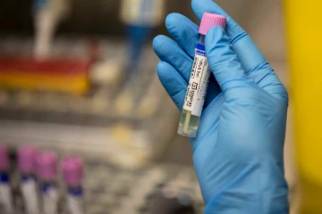 වඳුරු උණ, කොවිඩ් සහ HIV ‍යන රෝග තුනම වැළඳුණු රෝගියෙක් සොයාගැනේ