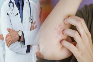 இலங்கையில் மீண்டும் தலைதூக்கும் தொழுநோய் ; சுகாதார அதிகாரிகள் எச்சரிக்கை