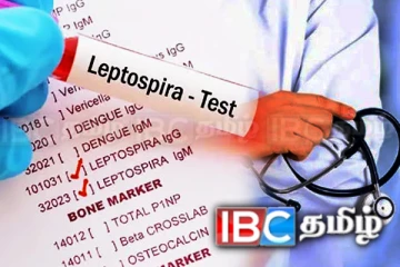 நாட்டு மக்களுக்கு தொற்றுநோய் குறித்து விசேட எச்சரிக்கை