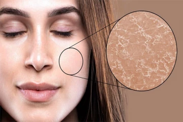 வறண்ட சருமத்தை போக்க இந்த ட்ப்ஸ ட்ரை பண்ணுங்க