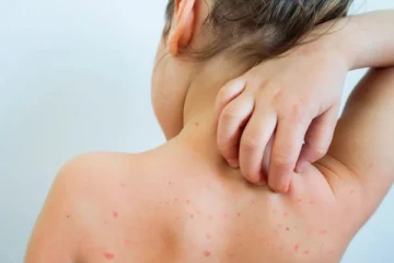 பொதுப்போக்குவரத்தைத் தவிர்க்கவும்: நோய்த்தொற்று பரவல் தொடர்பில் பிரித்தானிய மருத்துவர்கள் எச்சரிக்கை