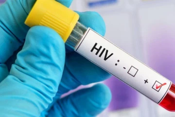 இளைஞர்களிடையே வேகமாக அதிகரிக்கும் HIV