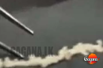 පිරිමි ළමයෙකුගේ සෙන්ටිමීටර 70ක් දිග එකක්??? අම්මෝ වාර්තාවක්