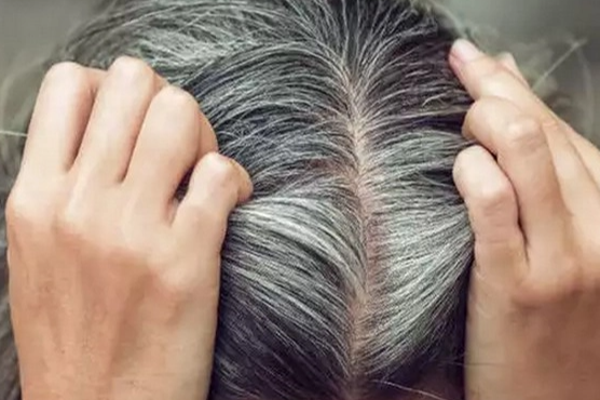 இனி இளநரையால் கவலை வேண்டாம்; விஞ்ஞானிகள் வெளியிட்ட தகவல்! | Hair Graying Don T Worry About Scientists