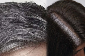 நரை முடியை இயற்கையாகவே கருமையாக்கலாம்; இதோ சில எளிய வழிகள்