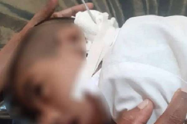 ஆரம்பபிரிவு மாணவர்களின் வாக்குவாதம் கழுத்தை பதம்பார்த்தது | A Needle Inserted Deep Into The Student Neck