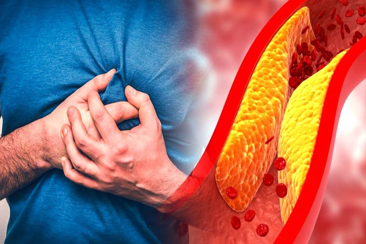 இந்த ஒரு காய் சாப்பிடுங்க - நரம்பில் சிக்கியுள்ள கெட்ட கொழுப்பு கரையும் | Beetroot Controls Cholesterol Improve Heart Health