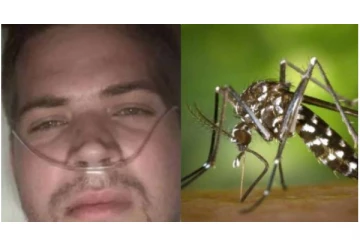 ஒரே ஒரு கொசுக்கடியால் கோமாவுக்குச் சென்ற நபர் - 30 ஆபரேஷன் செய்து உயிரை காப்பாற்றிய டாக்டர்கள்...!