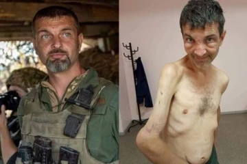 எலும்பும் தோலுமாக இருக்கும் உக்ரேனிய ராணுவ வீரர்! இணையத்தில் வைரலாகும் அதிர்ச்சிப் புகைப்படம்