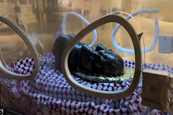 இன்குபேட்டரில் வைக்கப்பட்ட இயேசு பிரான் | Jesus Is A Frog In An Incubator