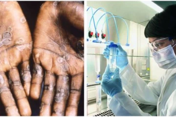 காற்று மூலம் பரவுகிறதா குரங்கு அம்மை - WHO எச்சரிக்கை!