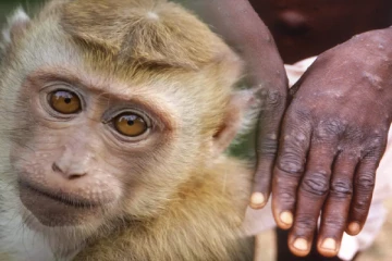 இலங்கையிலும் பரவியது குரங்கம்மை..! முதலாவதாக அடையாளம் காணப்பட்ட நபர்