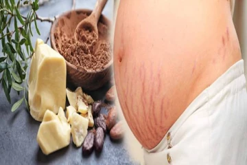 கர்ப்ப கால தழும்புகளை போக்கணுமா? அப்போ கோகோ பட்டர் தான் சிறந்த தெரிவு