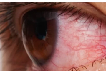 மெட்ராஸ் ஐ: பாதிக்கப்பட்டவர்கள் தனிமைப்படுத்திக் கொள்ளவும் - அமைச்சர்