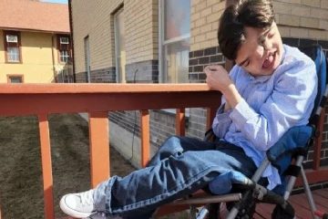 பிறக்கும் போதே இரண்டு முகம்; மருத்துவர்களின் கணிப்புகளை தவிடுபொடியாக்கிய இளைஞர்!