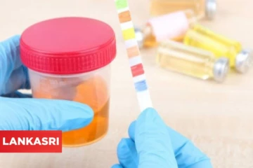 உங்கள் சிறுநீர் இந்த நிறங்களில் உள்ளதா? அப்போ இது தான் பிரச்சினை உஷார்!