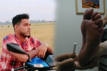 காலில் முள் குத்தி இளைஞன் உயிரிழப்பு: யாழில் சம்பவம்