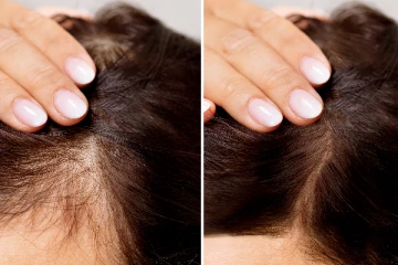 தலைமுடி காடு போல அடர்த்தியா வளரணுமா? இந்த இலைகளே போதுமானது