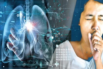 காசநோய் தொடர்பில் விடுக்கப்பட்டுள்ள எச்சரிக்கை