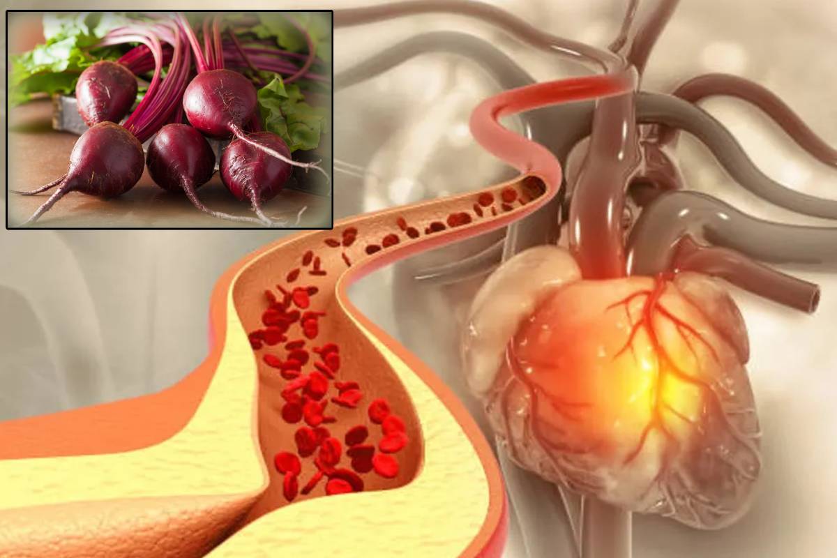 இந்த ஒரு காய் சாப்பிடுங்க - நரம்பில் சிக்கியுள்ள கெட்ட கொழுப்பு கரையும் | Beetroot Controls Cholesterol Improve Heart Health