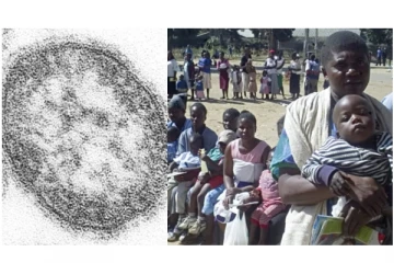 ஜிம்பாப்வே நாட்டில் பரவும் கொடூர நோய்…150க்கும் மேற்பட்ட குழந்தைகள் பலி - அதிர்ச்சி தகவல்