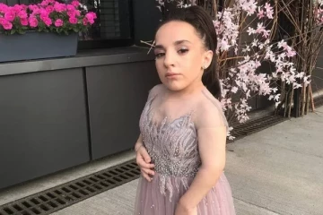 இரண்டரை அடி உயரமே உள்ள ரஷ்யப் பெண்: உக்ரைன் தாக்குதலால் சந்தித்துவரும் கஷ்டங்கள்