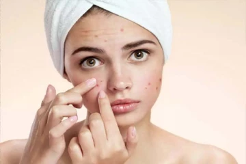 முகத்தில் பருக்கள் அதிகமாக இருக்கின்றதா? வாழைப்பழ தோல் மட்டும் போதும்