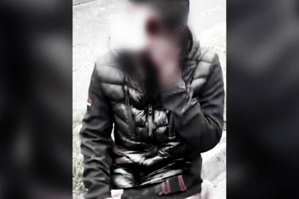 அயர்லாந்தில் சரமாரியாக தாக்கப்பட்ட இந்தியர்: தொடரும் பதற்றம் | Racist Attack On Indian Origin Youth In Ireland