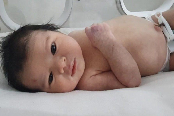 பூகம்பத்தில் பூத்த பூமகள் : குழந்தையை தத்தெடுக்க உலகெங்கும் ஆர்வம் காட்டும் மக்கள் | Thousands Around World Adopt Miracle Baby