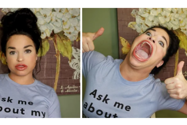 அடேங்கப்பா.. உலகிலேயே மிகப்பெரிய வாய் - பிரபலமான இளம்பெண்! | Woman With The Biggest Mouth In The World