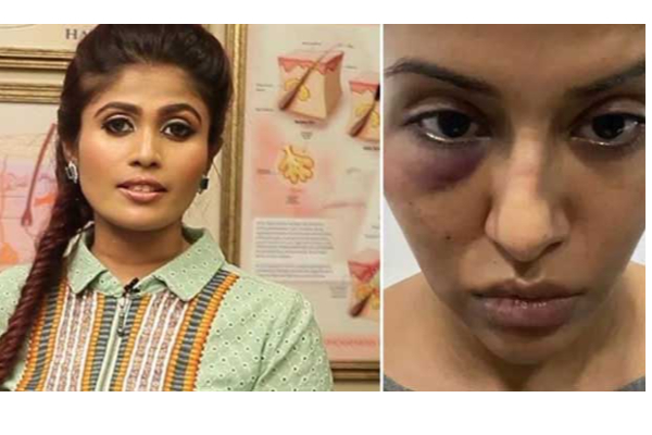 முகம் அலங்கோலமாக மாறியதால் ரைஸா கேட்ட நஷ்டஈடு... மானநஷ்ட வழக்கு பதிவுசெய்ய தயார்! பெண் பகீர் | Raiza Face Allergy Beauty
