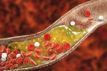 உங்க உடம்பில் கொழுப்பு அதிகமா இருக்கா? இதனை எப்படி எளியமுறையில் குறைக்கலாம்?