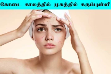 முகத்தில் கரும்புள்ளிகளை போக்க என்ன செய்யலாம்? எளிய அழகு குறிப்பு இதோ