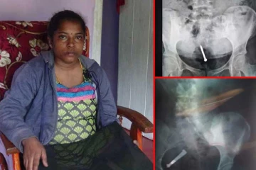 உணவுக்கு பதிலாக கொங்கிரீட் ஆணிகள்; இலங்கை பெண்ணுக்கு நேர்ந்த கொடூரம்