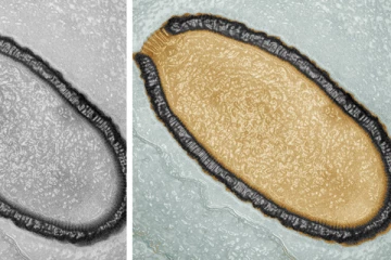 ලෝකයම අවදානමක හෙළමින් - වසර දස දහස් ගණනක් නිද්‍රාශීලීව පැවතී " zombie" වෛරසයක් සොයා ගැනේ. (VIDEO)