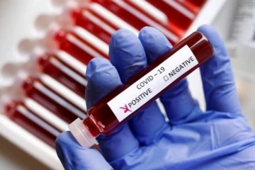 வவுனியாவில் மேலும் 50 பேருக்கு கோவிட் தொற்று உறுதி