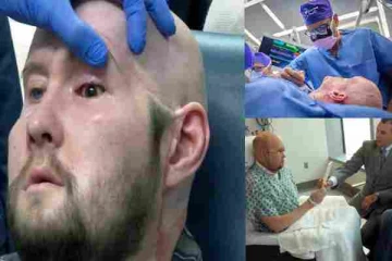 உலகின் முதலாவது கண் மாற்று சத்திரசிகிச்சை : பெருமிதம் கொள்ளும் வைத்தியர்கள்