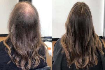 அசுர வேகத்தில் தலைமுடி நன்றாக வளரவைக்கும் மூலிகை!